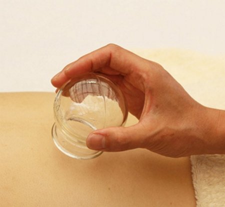 Массажные банки, аппарат для вакуумного массажа