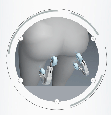 Массажная накидка для спины tiktonik от Top Technology